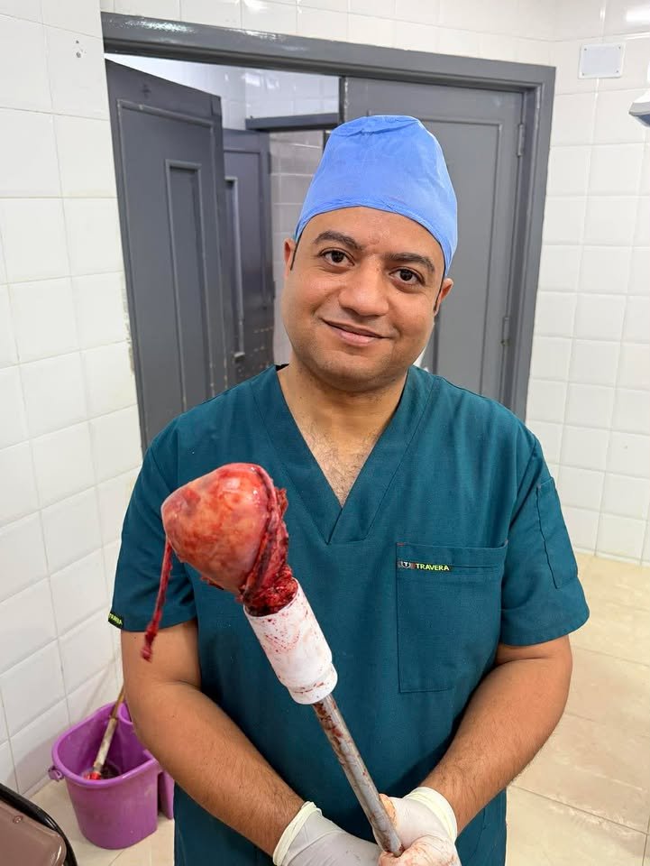 استئصال رحم بالمنظار تغدد رحمي