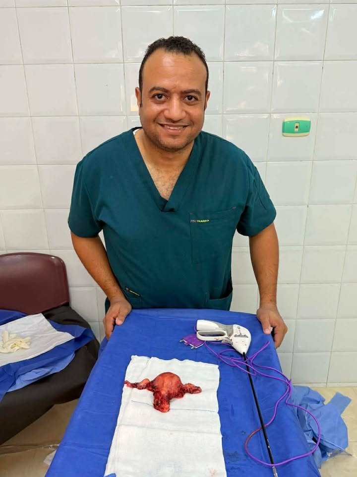 استئصال رحم بالمنظار