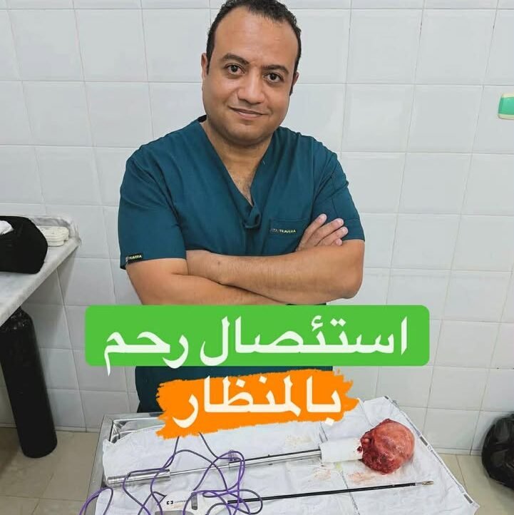 استئصال الرحم بالمنظار