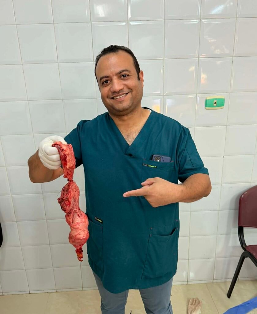 استئصال كلي للرحم بالمنظار