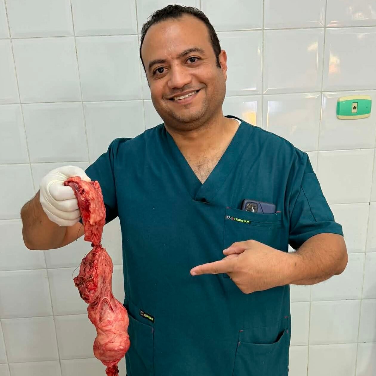 استئصال رحم كبير بالمنظار بعد قطعه الي جزئين داخل البطن لإخراجه من فتحة المهبل