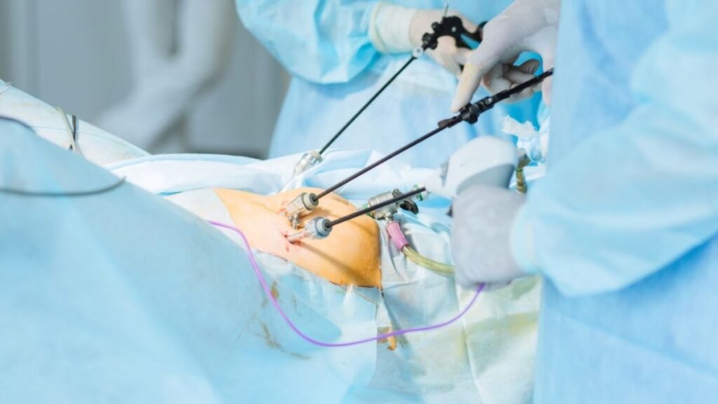 علاج تاخر الانجاب والحقن المجهرى