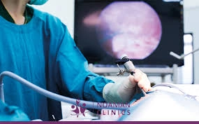 جراحات مناظير امراض النساء المتقدمه 9 جراحات المناظير النسائيه المتقدمه