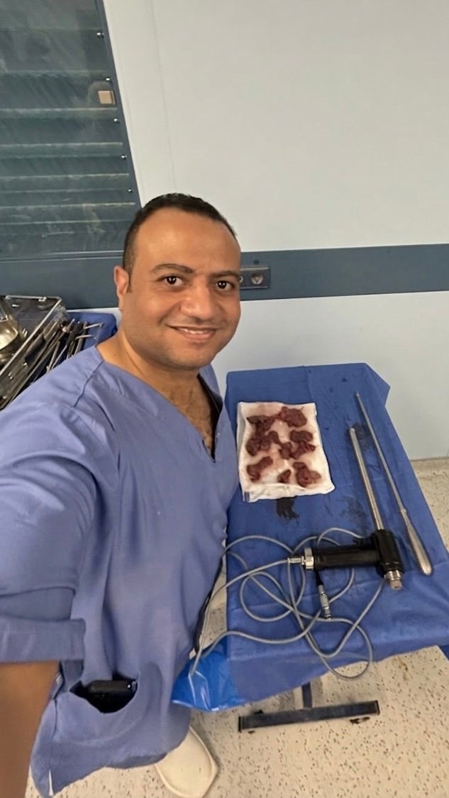 استئصال ورم ليفي بالمنظار