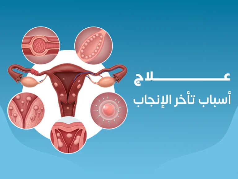 علاج أسباب تأخر الإنجاب في السويس