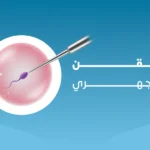 علاج اسباب تأخر الانجاب 3 الحقن المجهري
