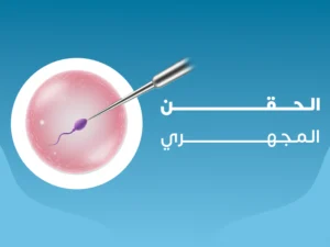 الحقن المجهري