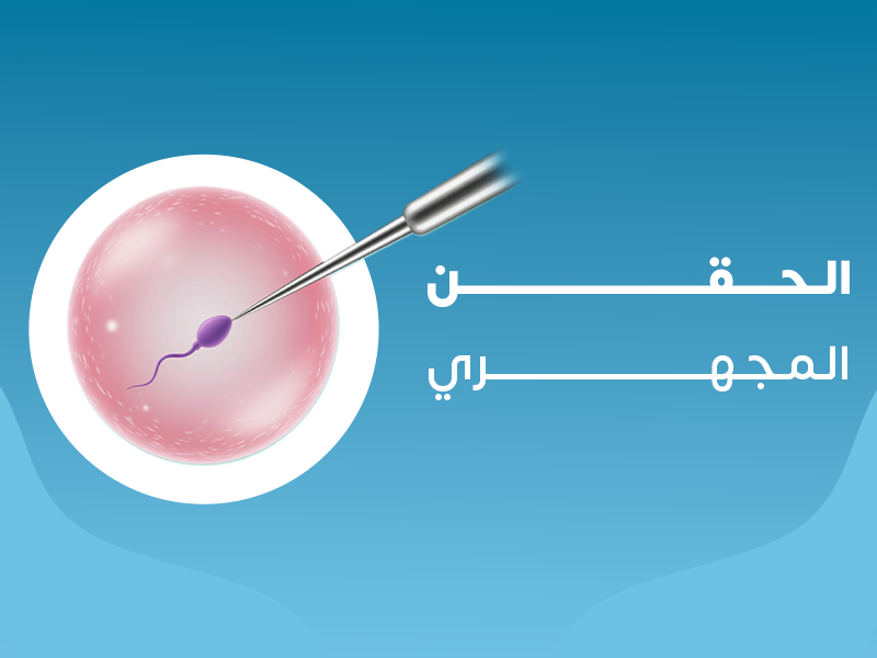 الحقن المجهري