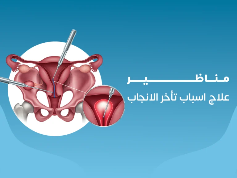 أ.د/ محمد فوزي الطويل – جراح التوليد وأمراض النساء بالسويس 9 مناظير علاج أسباب تأخر الإنجاب
