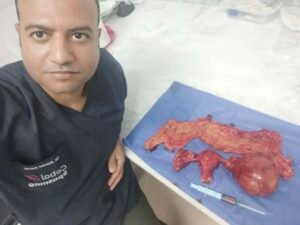 الجراحة الكاملة لاستئصال اشتباه ورم خبيث بالمبيض