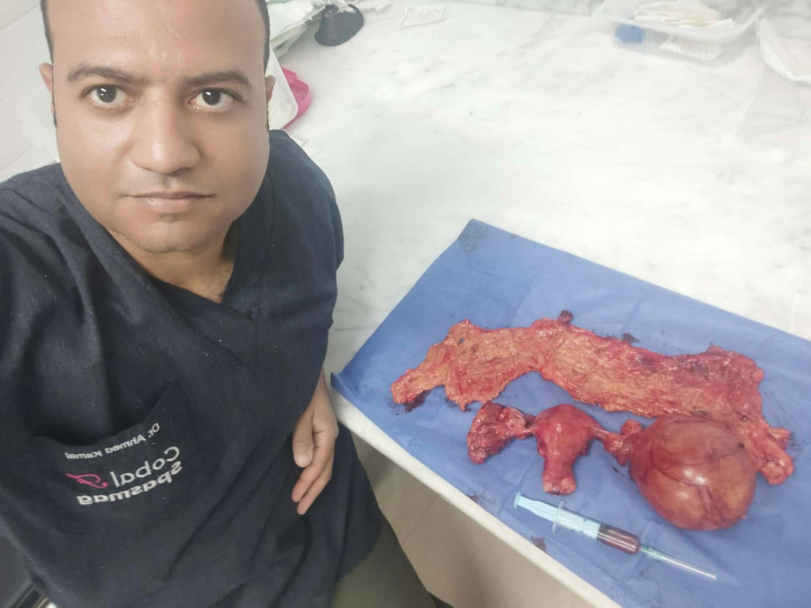 الجراحة الكاملة لاستئصال اشتباه ورم خبيث بالمبيض