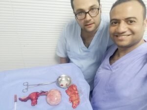مناظير أكياس و أورام المبيض